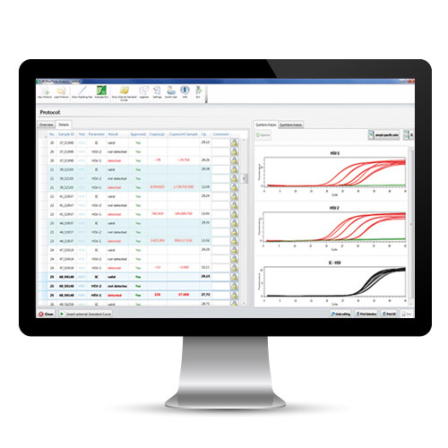 EURORealTime Analysis