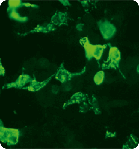 110127-145_NMDAR_G_unv__40x__4@2x