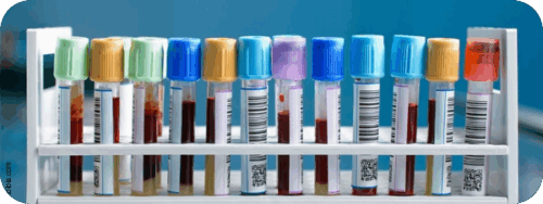 RA_ELISA_Titel_34230192@2x