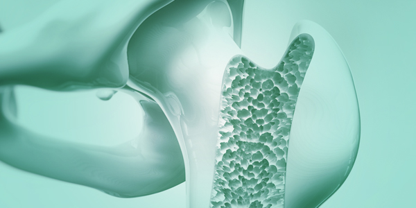 Contact Bone metabolism Product Team